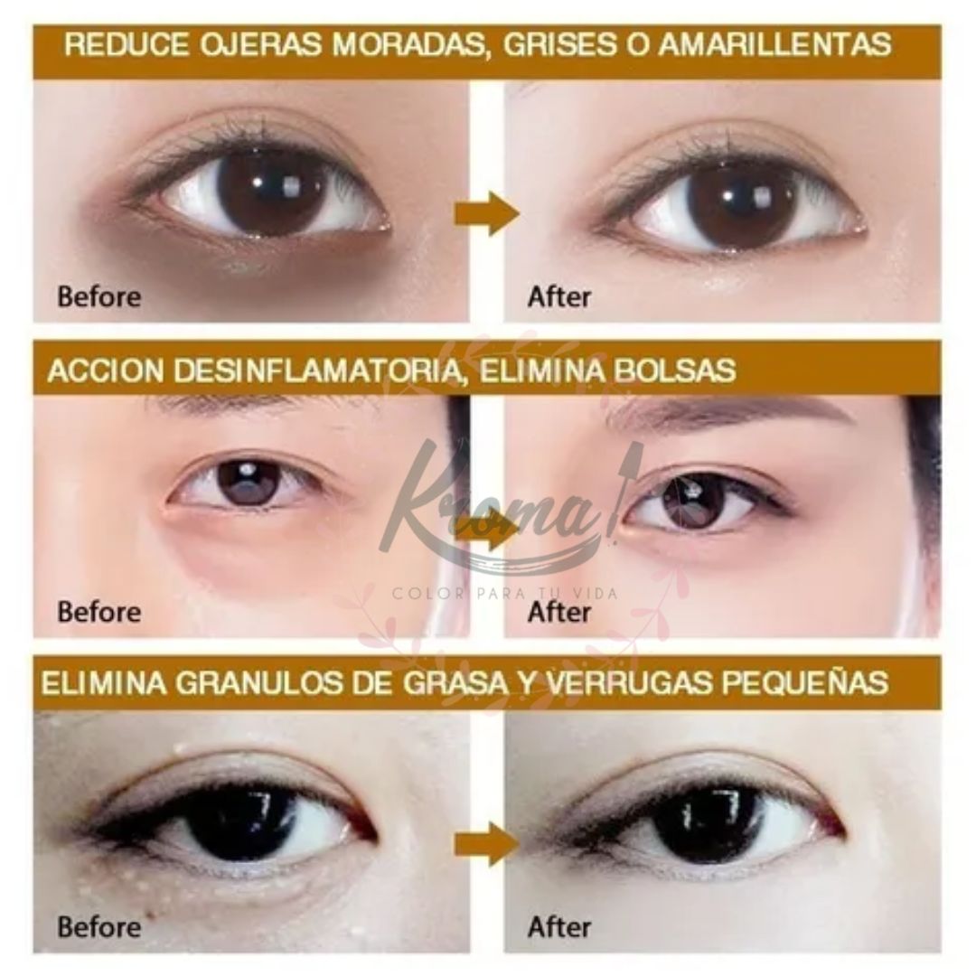 Parches de hidrogel con perla marina para contorno de ojos con manchas, pecas y bultos - Imagen 4